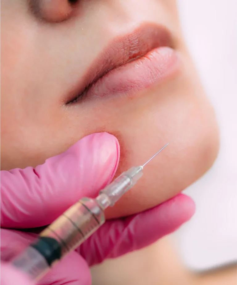 Çene Dolgusu - Fethiye