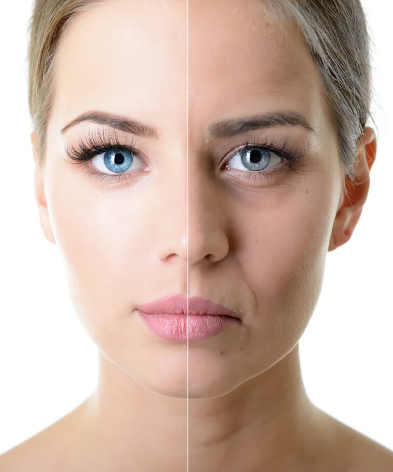 Facial Botox in Fethiye