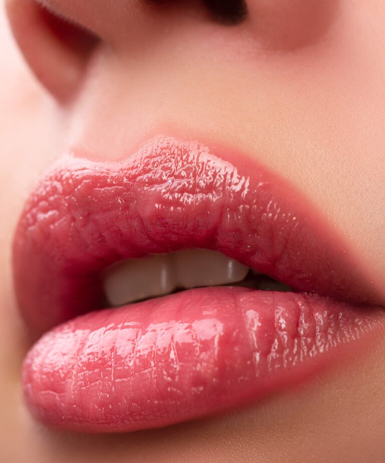 Lip Fillers in Fethiye